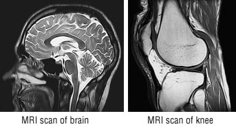 Patient Basics: Magnetic Resonance Imaging (MRI) - 2 Minute Medicine