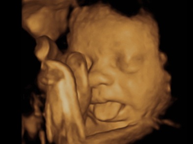 About 3DBabyVu Pleasanton - 3DBabyVu - 3D 4D Ultrasound in the San Francisco Bay Area, California