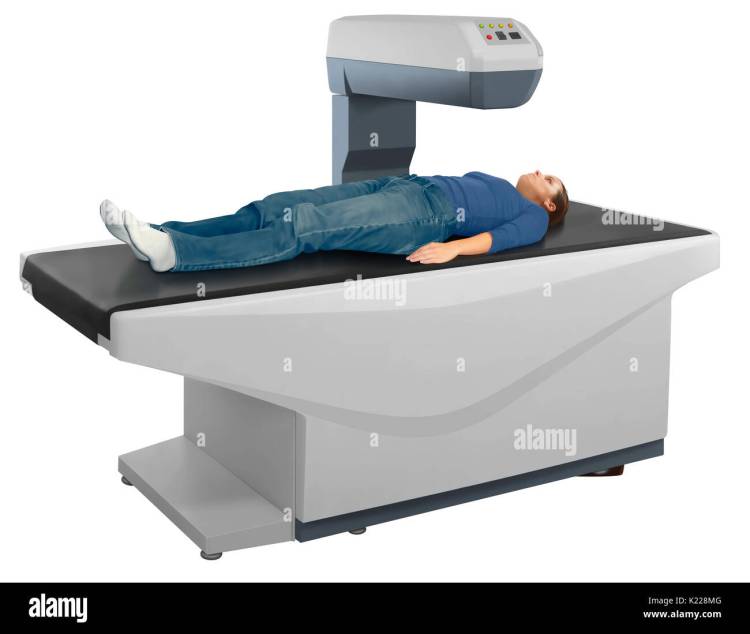 Bone mineral density (BMD) testing, or bone densitometry, is a medical imaging technique. It makes it possible to measure loss of bone mass, and therefore diagnose and monitor the development of osteoporosis.