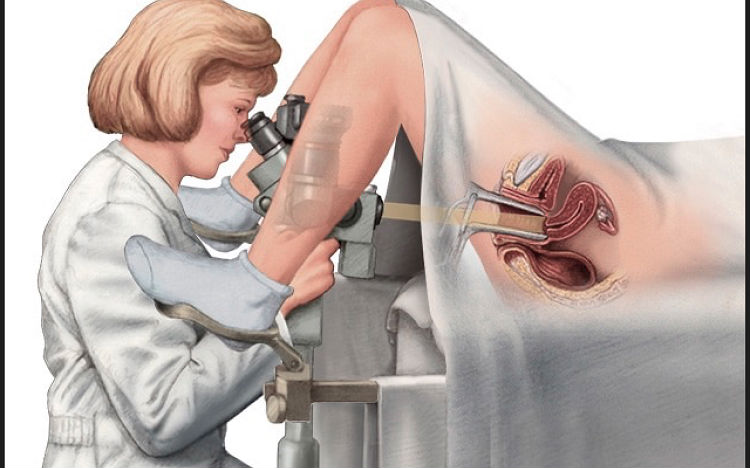 Colposcopy - Dr Shammas