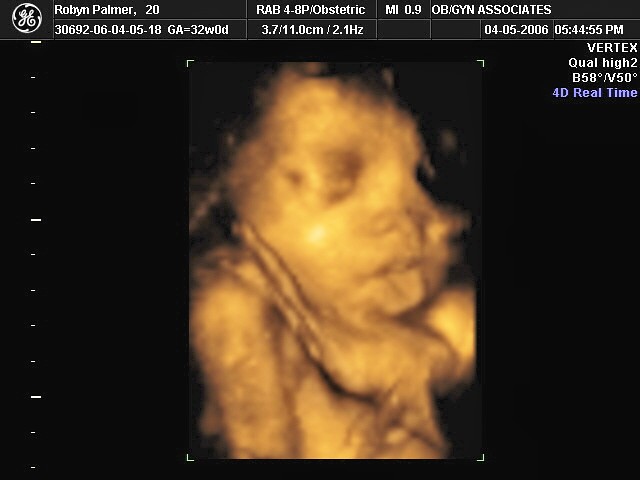 Carsons 3d Ultrasound - Debi Stith - Flickr