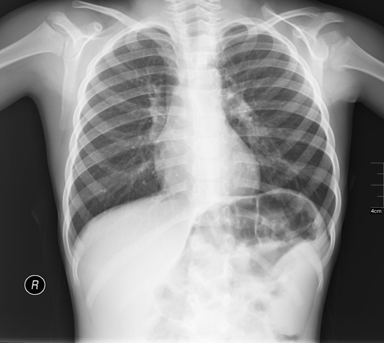 File:Radiology ND 0127 ADU.jpg - Wikimedia Commons