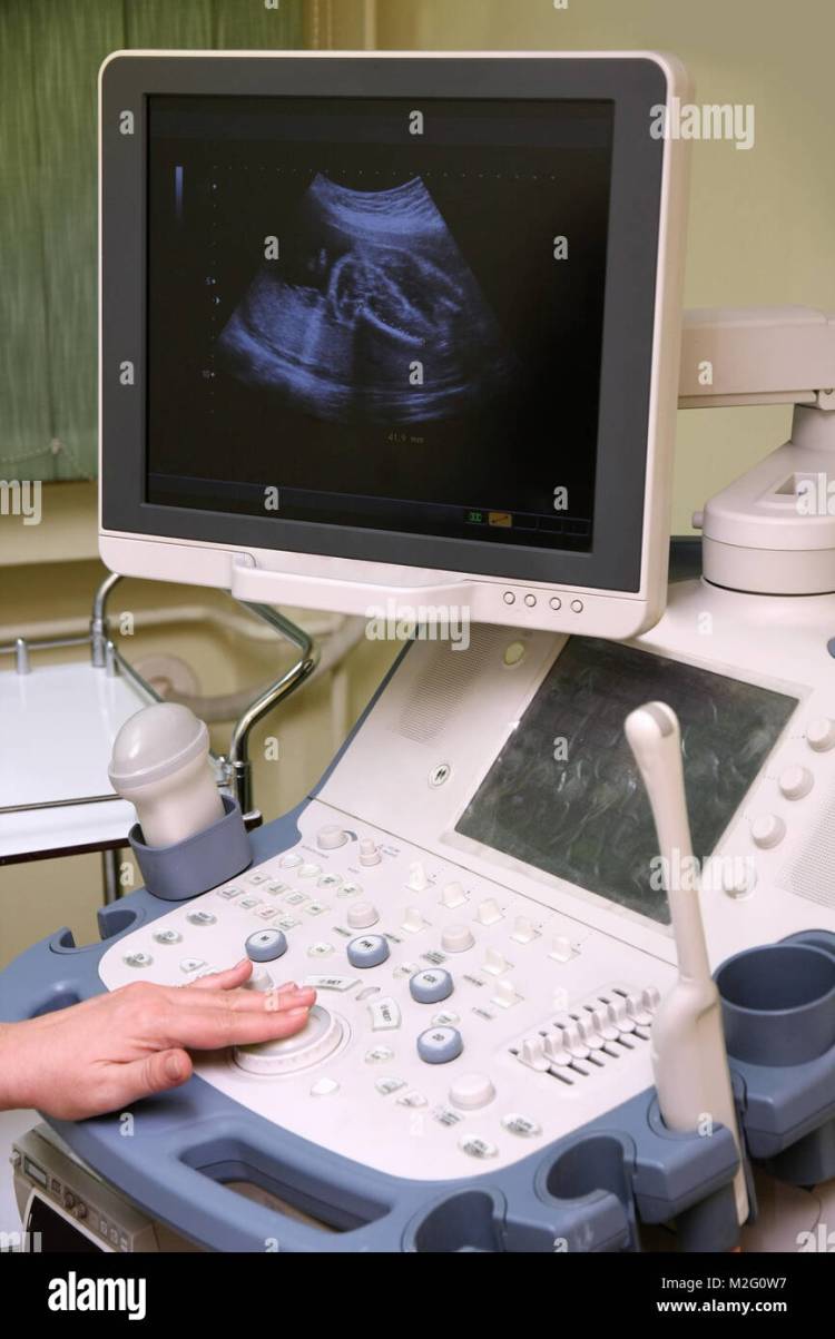 gynecological ultrasound