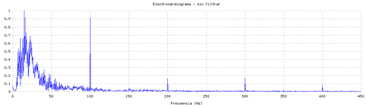 electrocardiograma
