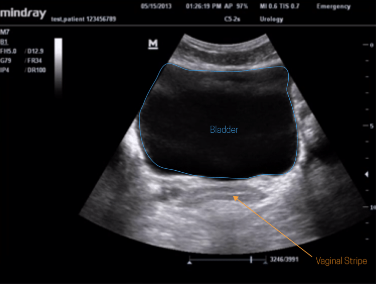 hepatobiliary ultrasound